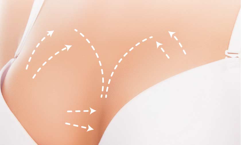 PRP Breast Enhancement - Sunshine Health