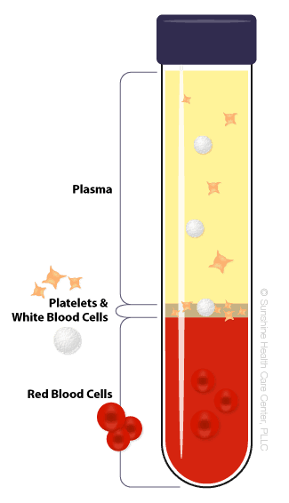 Illustration of the separate components of blood and plasma after it has been centrifuged